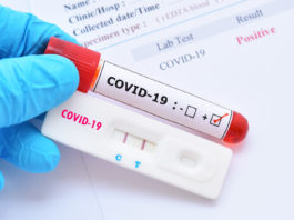 Au fost înregistrate 699 de cazuri noi de persoane infectate cu COVID-19, acestea fiind cazuri care nu au mai avut anterior un test pozitiv