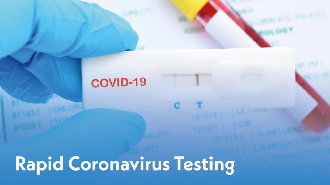 Au fost înregistrate 9 cazuri noi de COVID-19, la 1.289 de teste efectuate
