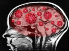 Creierele pacienţilor morţi de Covid, similare cu ale bolnavilor de Parkinson sau Alzheimer