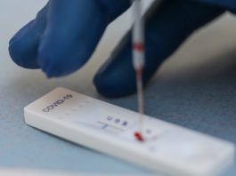Au fost efectuate 7.307 teste RT-PCR (3.875 în baza definiției de caz și 3.432 la cerere) și 12.831 de teste rapide antigenice