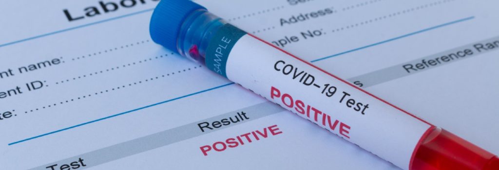 Peste 500 de cazuri noi de infectare cu COVID-19