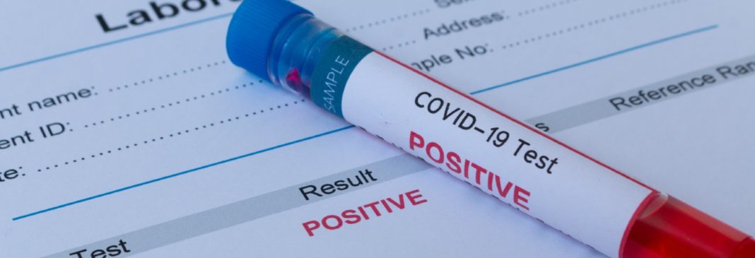 test anticorpi medlife _1727889874 Au fost înregistrate 544 cazuri noi de persoane infectate cu COVID-19, acestea fiind cazuri care nu au mai avut anterior un test pozitiv