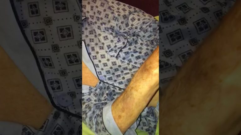 (VIDEO) Gorj: Nonagenar cu COVID, externat din spital cu lovituri