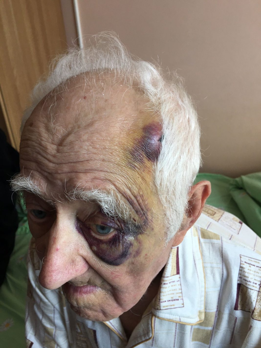 nonagenar gorj IPJ Gorj face verificări în cazul nonagenarului cu COVID, externat cu lovituri