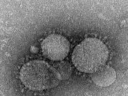 Cercetătorii cred că restricțiile anti-Covid ar fi dus la dispariția uneia din tulpinile majore de gripă
