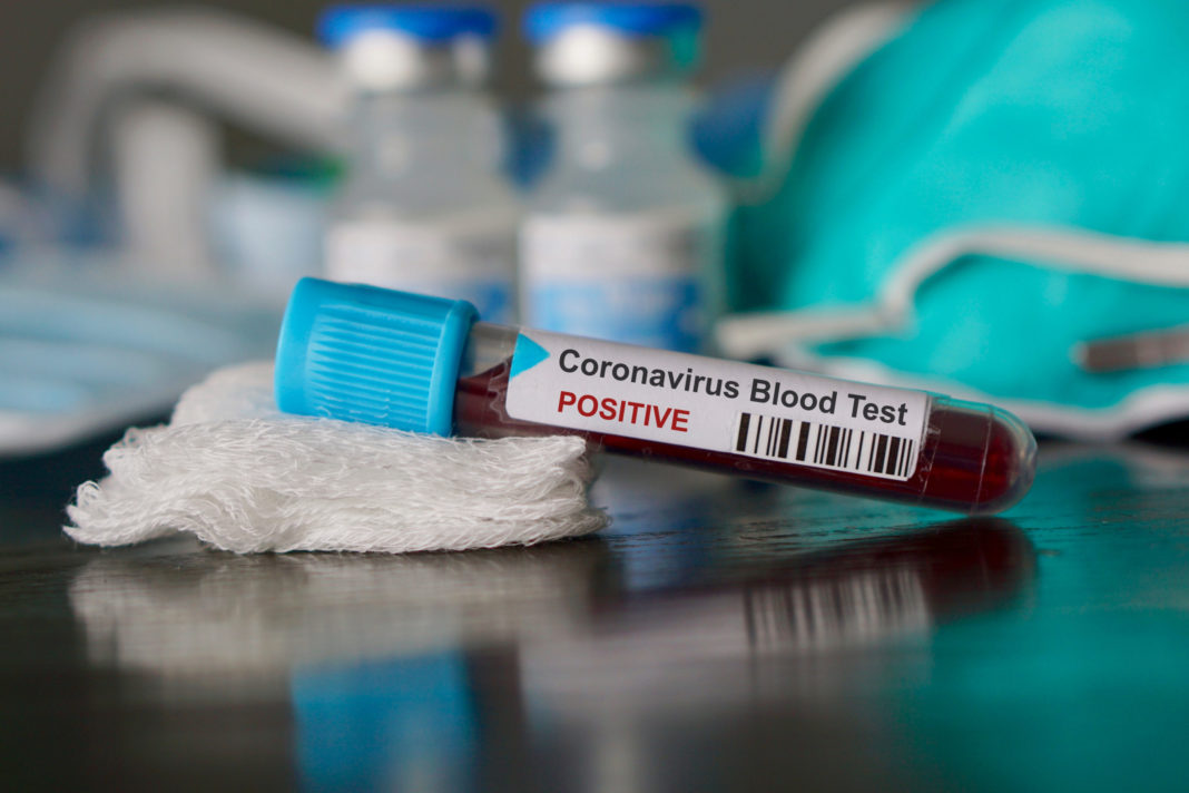 Gorj: 148 de cazuri noi de coronavirus și un deces1.557 de persoane au fos