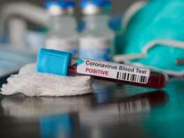Gorj: 148 de cazuri noi de coronavirus și un deces1.557 de persoane au fos