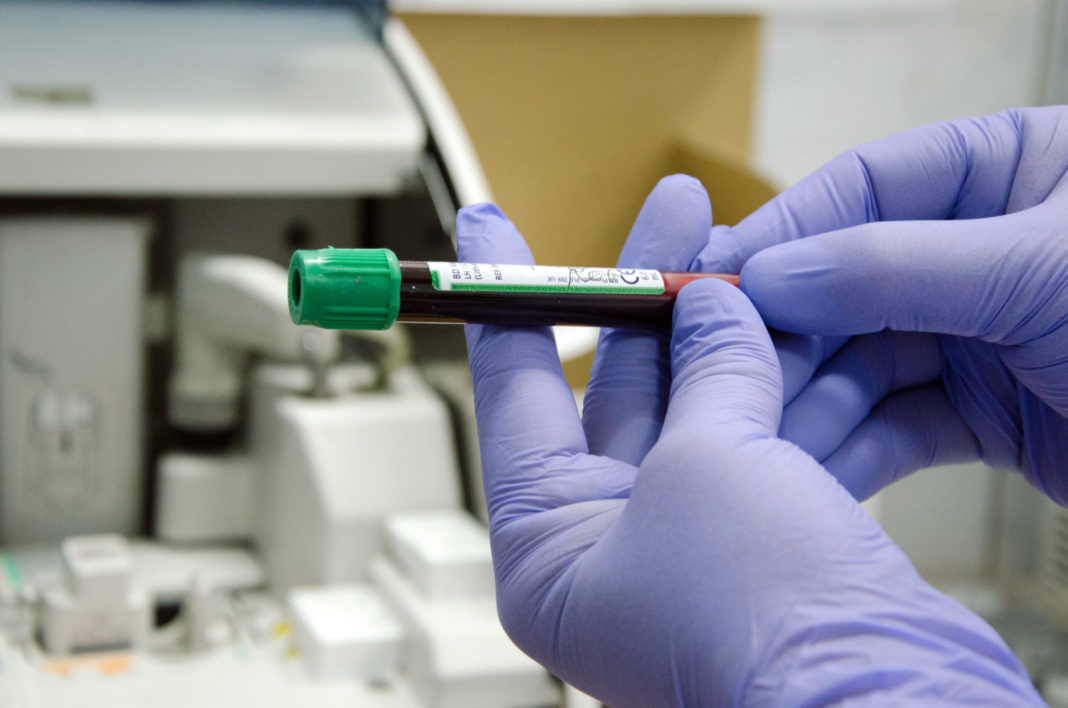 În ultimele 24 de ore au fost efectuate 2.024 teste RT-PCR ( 1.482 în baza definiției de caz și a protocolului medical și 542 la cerere) și 13.013 teste rapide antigenice