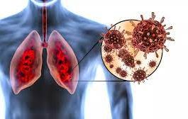 Medic, despre ravagiile făcute de COVID: ”La 85% afectare pulmonară nu mai ai plămân„