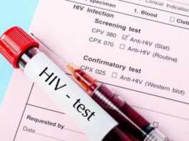 Caz medical extrem de rar: O femeie s-a vindecat de HIV fără tratament