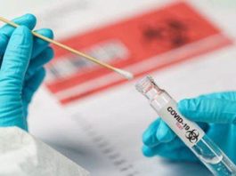 Test PCR negativ solicitat la intrarea în Cehia