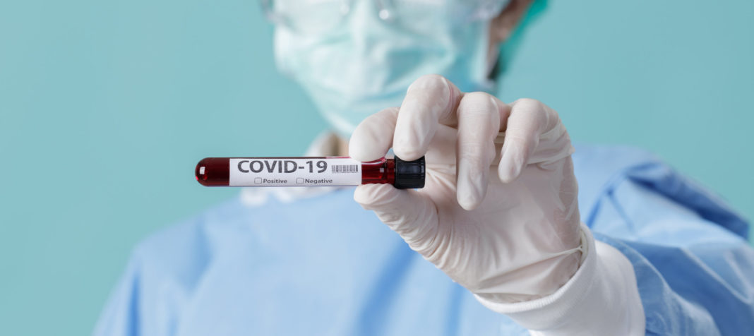 Au fost înregistrate 16.610 de cazuri noi de persoane infectate cu SARS-CoV-2 (COVID-19), cu 150 mai puțin decât în ziua anterioară