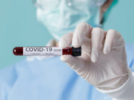 Au fost înregistrate 16.610 de cazuri noi de persoane infectate cu SARS-CoV-2 (COVID-19), cu 150 mai puțin decât în ziua anterioară