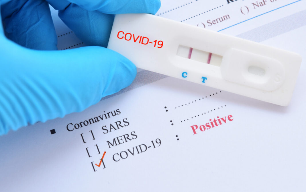 În ultimele 24 de ore s-au înregistrat 802 cazuri noi de COVID-19, la 2.731 de teste efectuate