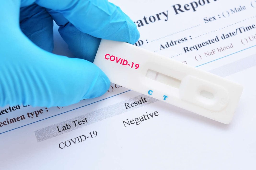 Au fost efectuate 6.834 de teste RT-PCR (3.155 în baza definiției de caz și a protocolului medical și 3.679 la cerere) și 22.906 teste rapide antigenice