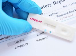 Au fost efectuate 6.834 de teste RT-PCR (3.155 în baza definiției de caz și a protocolului medical și 3.679 la cerere) și 22.906 teste rapide antigenice