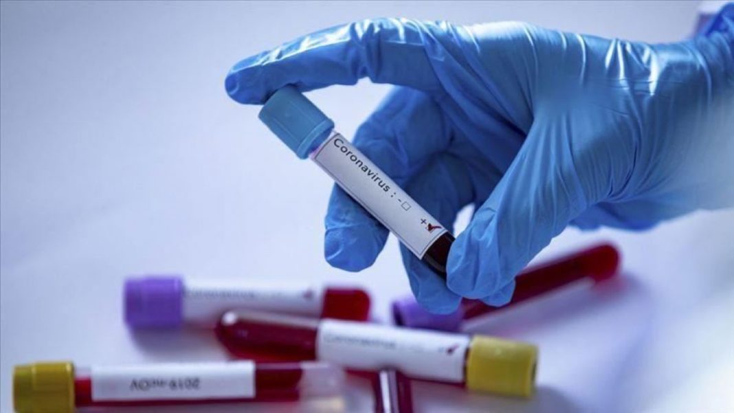 În ultimele 24 de ore au fost efectuate 5.855 teste RT-PCR