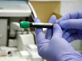 În ultimele 24 de ore au fost efectuate 4.563 teste RT-PCR ( 2.959 în baza definiției de caz și a protocolului medical și 1.604 la cerere) și 21.089 teste rapide antigenice