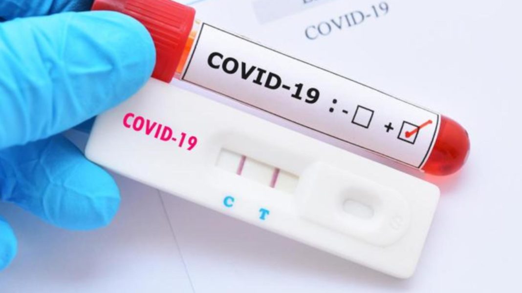 528 de infectări şi 3 decese Covid-19 în ultimele 24 de ore