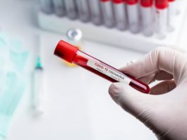 În ultimele 24 de ore au fost efectuate 4.490 teste RT-PCR ( 2.506 în baza definiției de caz și a protocolului medical și 1.984 la cerere) și 13.962 teste rapide antigenice