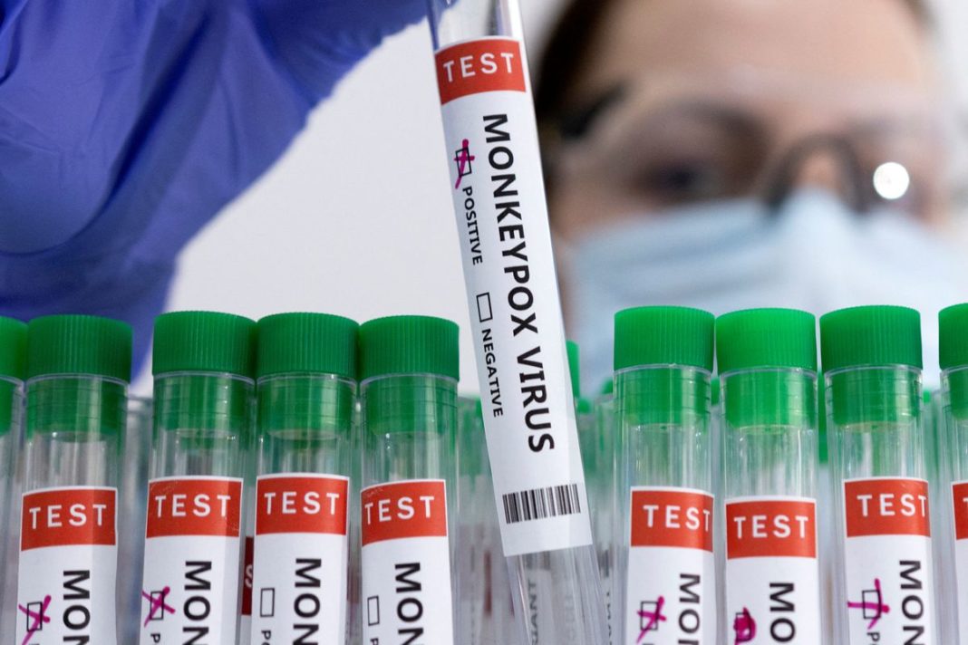 Tuburi de testare etichetate „pozitiv pentru virusul variolei maimuței”