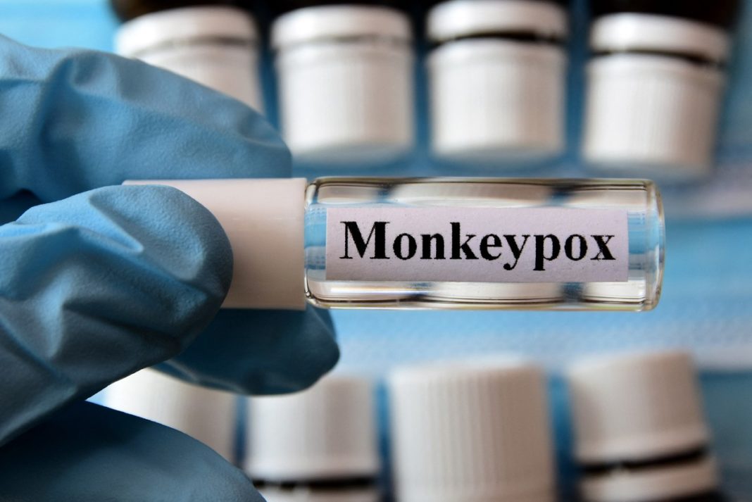 Două cazuri noi de variola maimuței, diagnosticate în România