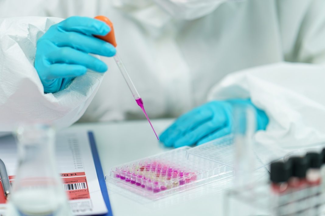 Rusia a raportat primul pacient care suferă de variola maimuţei, a anunţat marţi agenţia sanitară Rospotrebnadzor, precizând că persoana bolnavă