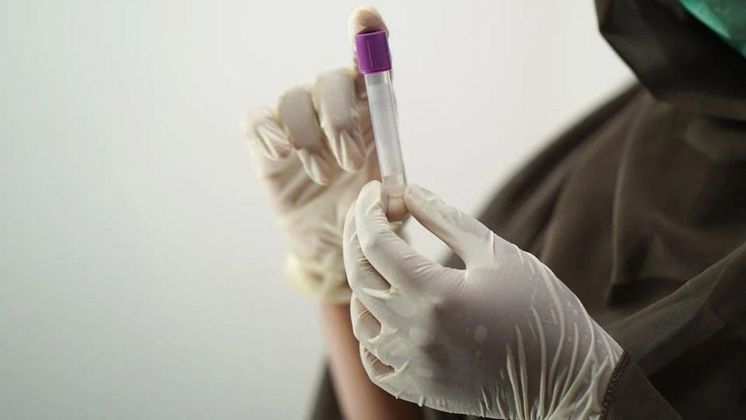 Un nou caz de variola maimuței în România . Acesta ar fi al 22 -lea caz