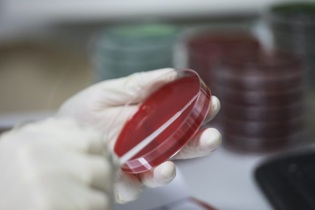 Bărbatul cu botulism internat în Spitalul Judeţean Slatina a murit