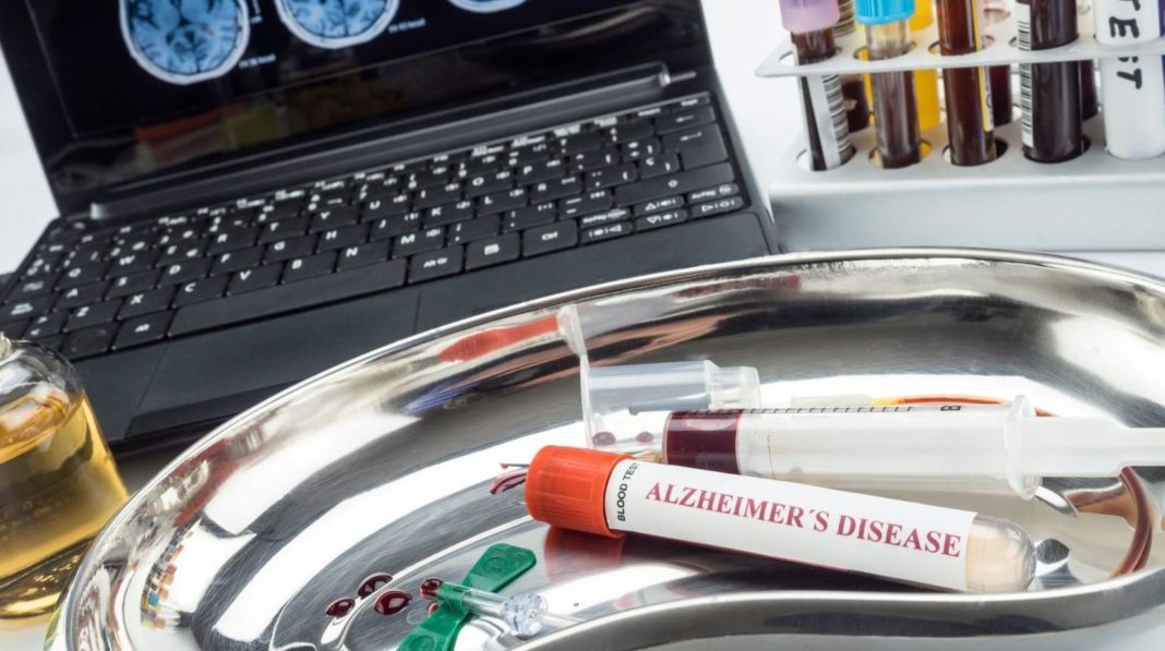 Test de sânge pentru diagnosticarea bolii Alzheimer, autorizat în Japonia