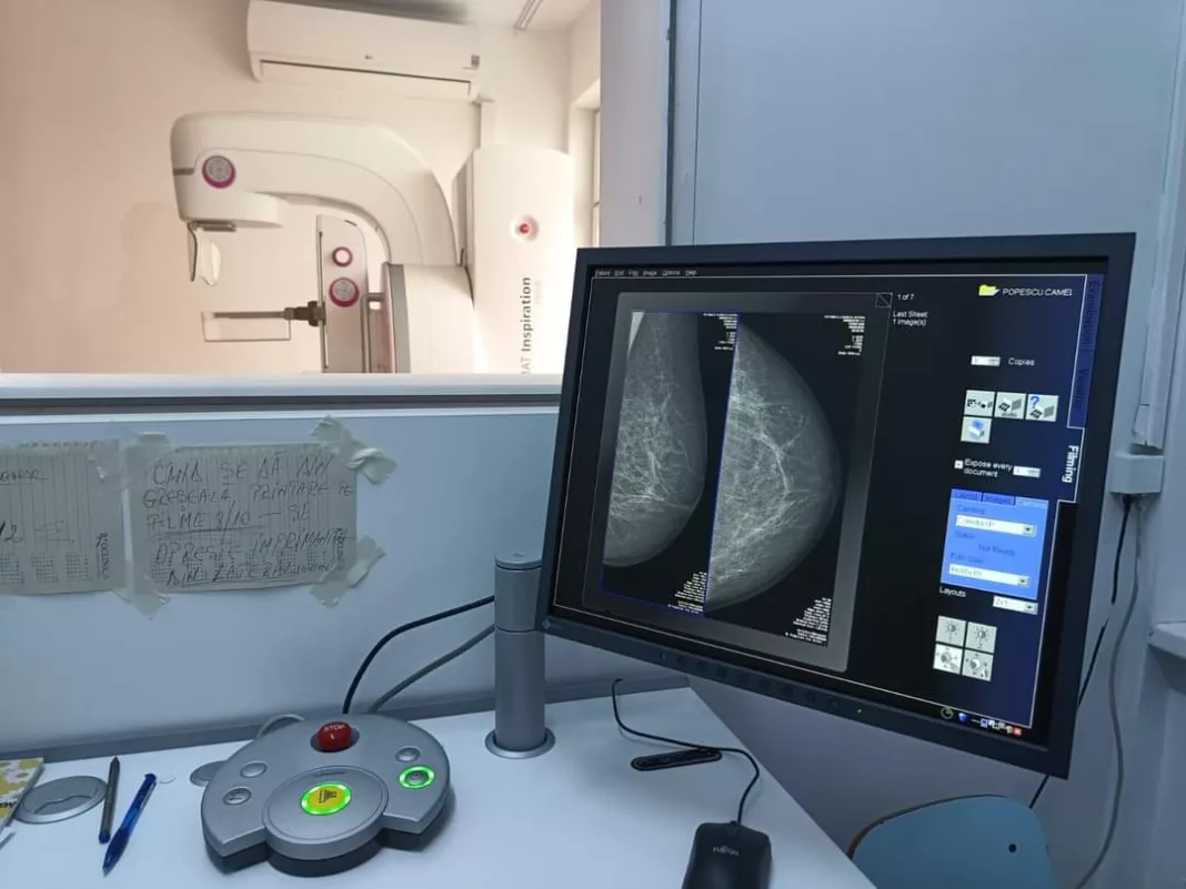 Echipament modern pentru depistarea cancerului la sân, la Spitalul Județean Târgu Jiu