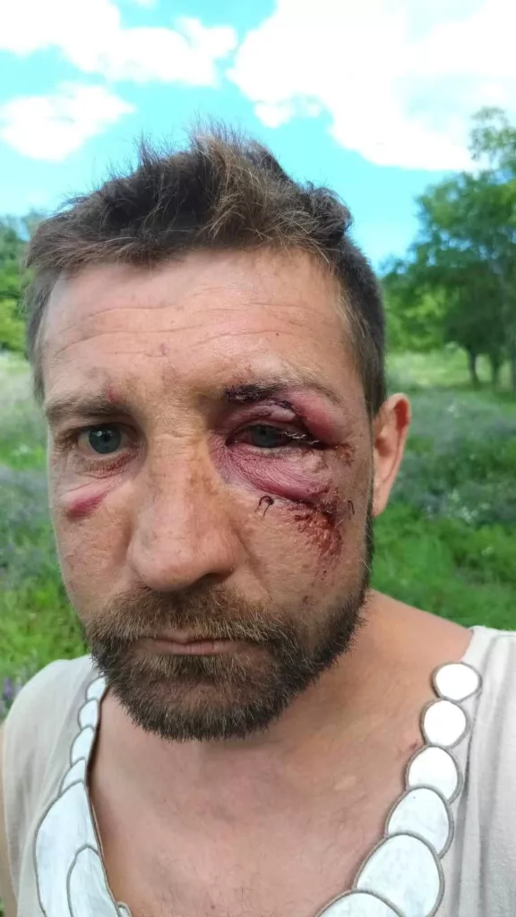 Dosar penal în cazul bărbatului desfigurat și abandonat într-o râpă