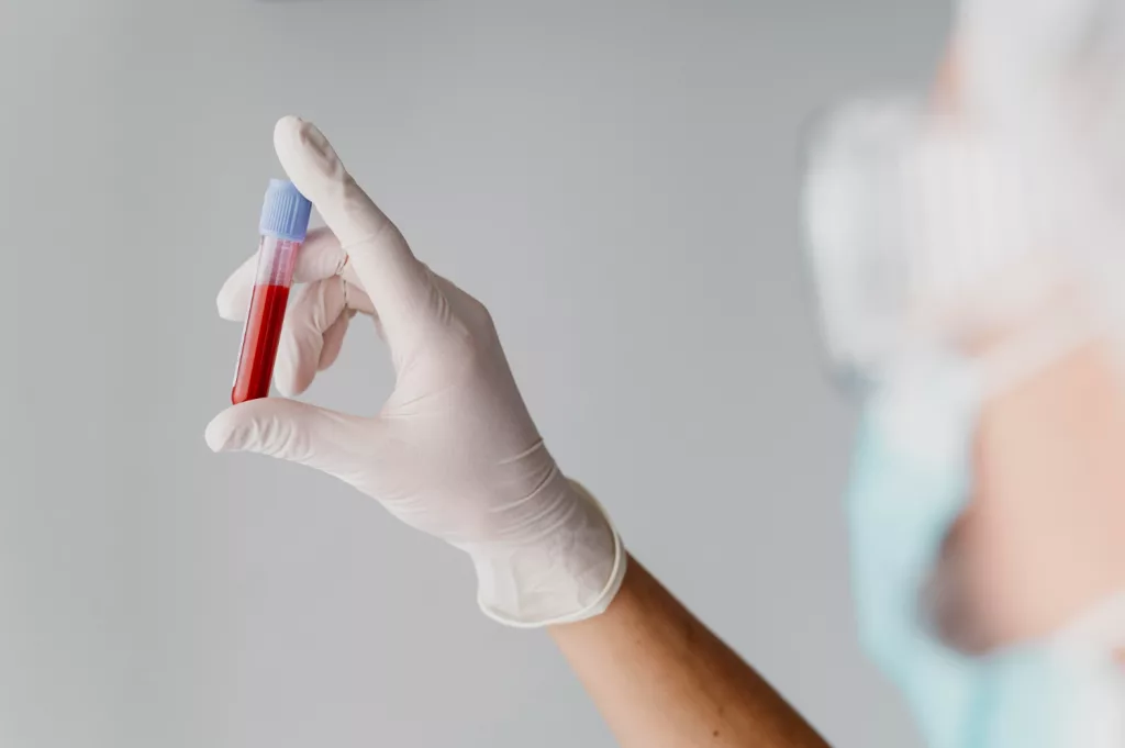 Transfuziile cu sânge tânăr ar putea fi încetini îmbătrânirea
