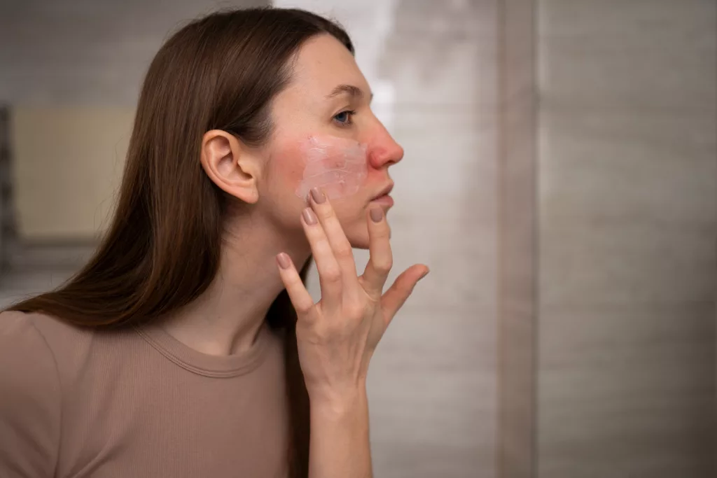 3 din 5 persoane cu dermatită atopică moderată sau severă nu ţin afecţiunea sub control