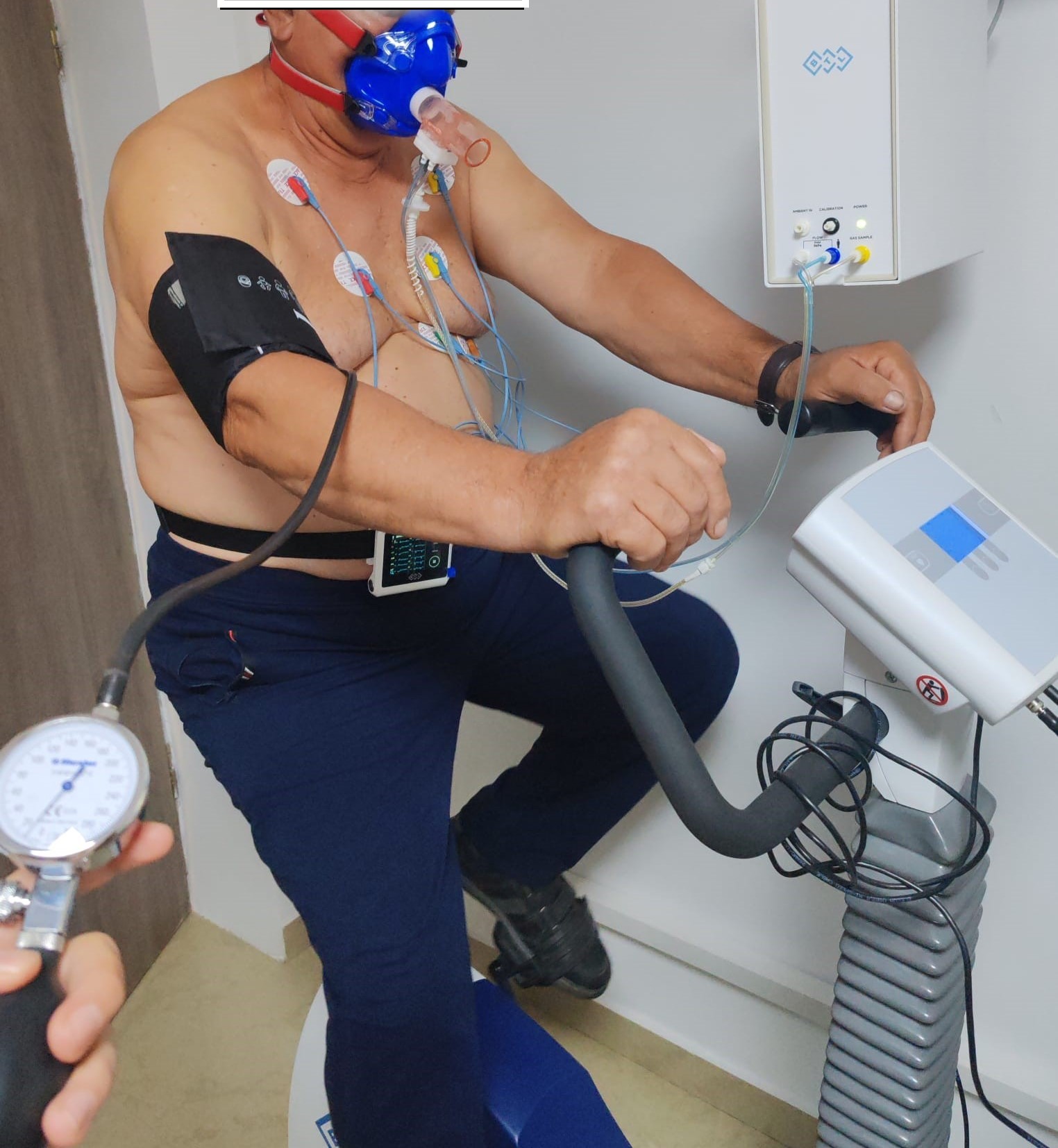 心肺運動検査は心臓と肺の健康状態のバロメーターとなり得る