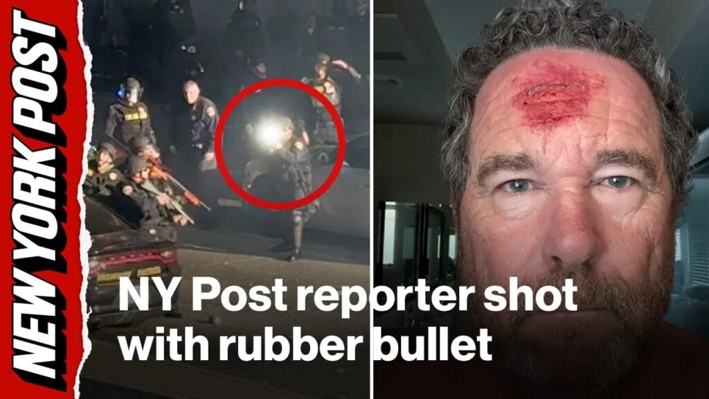(VIDEO) Jurnalist împușcat în cap în timp ce filmează la protestele din Los Angeles