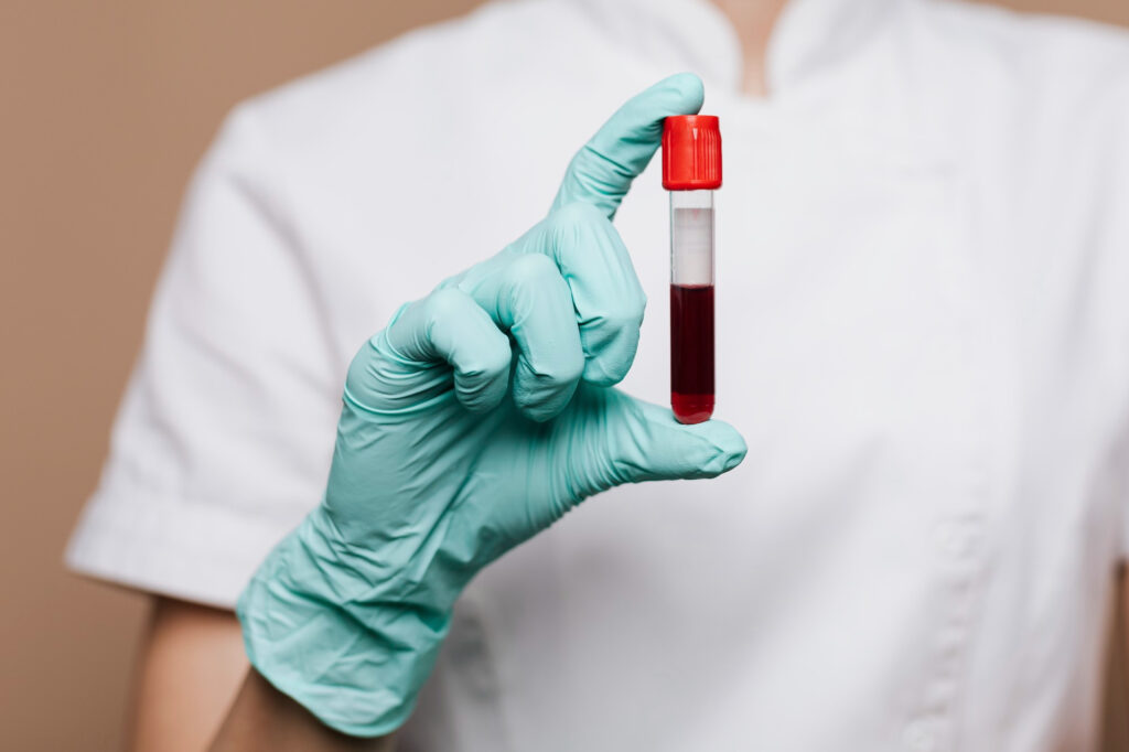 Studiu: Un test de sânge poate estima vârsta biologică a organelor umane