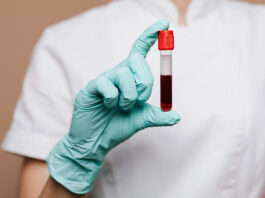 Studiu: Un test de sânge poate estima vârsta biologică a organelor umane