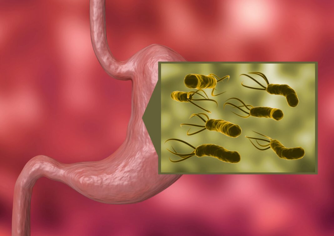 Bacteria Helicobacter Pylori ar putea provoca milioane de cazuri de cancer de stomac