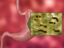 Bacteria Helicobacter Pylori ar putea provoca milioane de cazuri de cancer de stomac