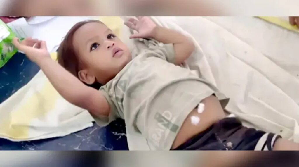 Bebeluș de un an din India își apără viața mușcând o cobră ce l-a atacat în curte