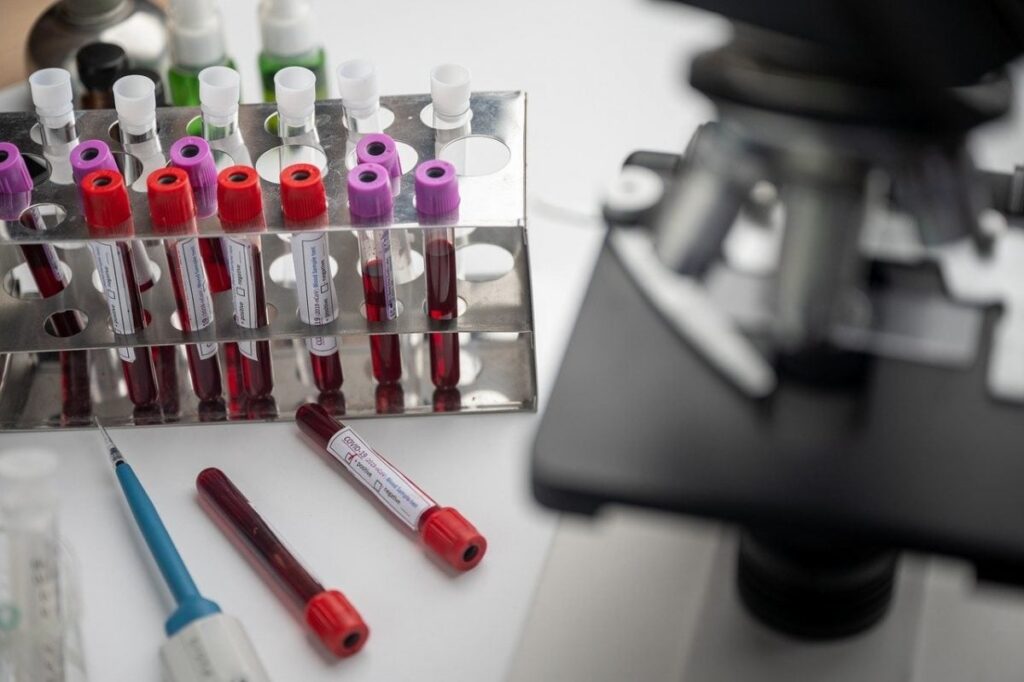 Test Simplu de Sânge Promite Detectarea Timpurie a Cancerului Ovarian
