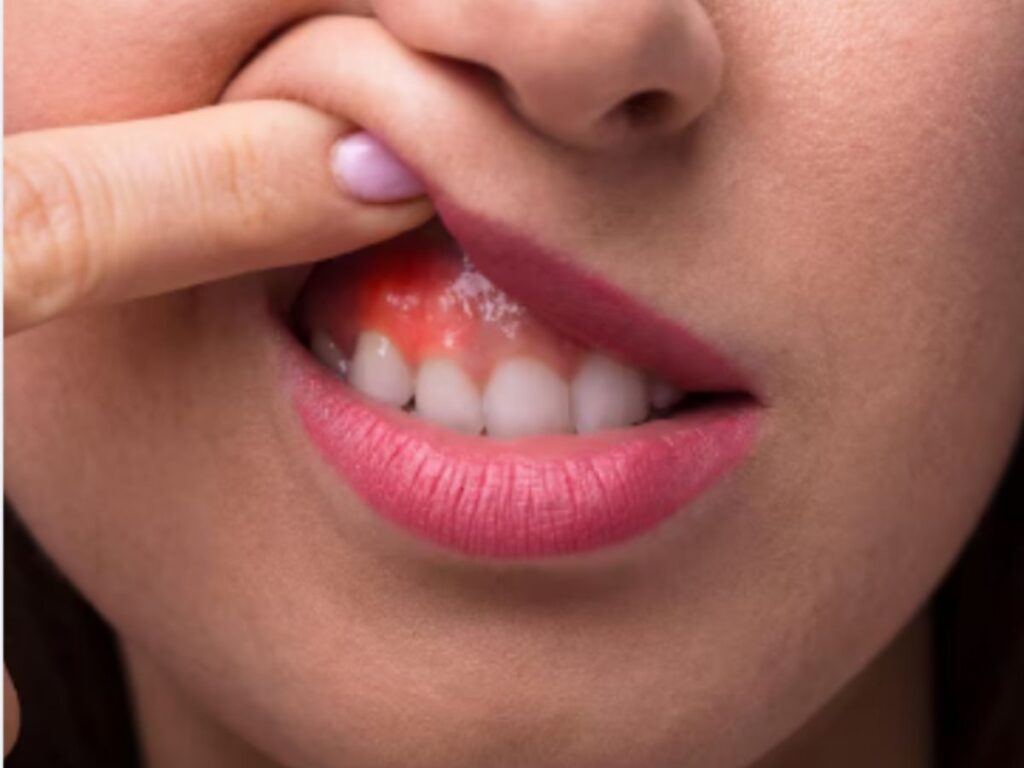 De ce este periculos dacă îți sângerează gingiile. Semnalul de alarmă care nu trebuie ignorat