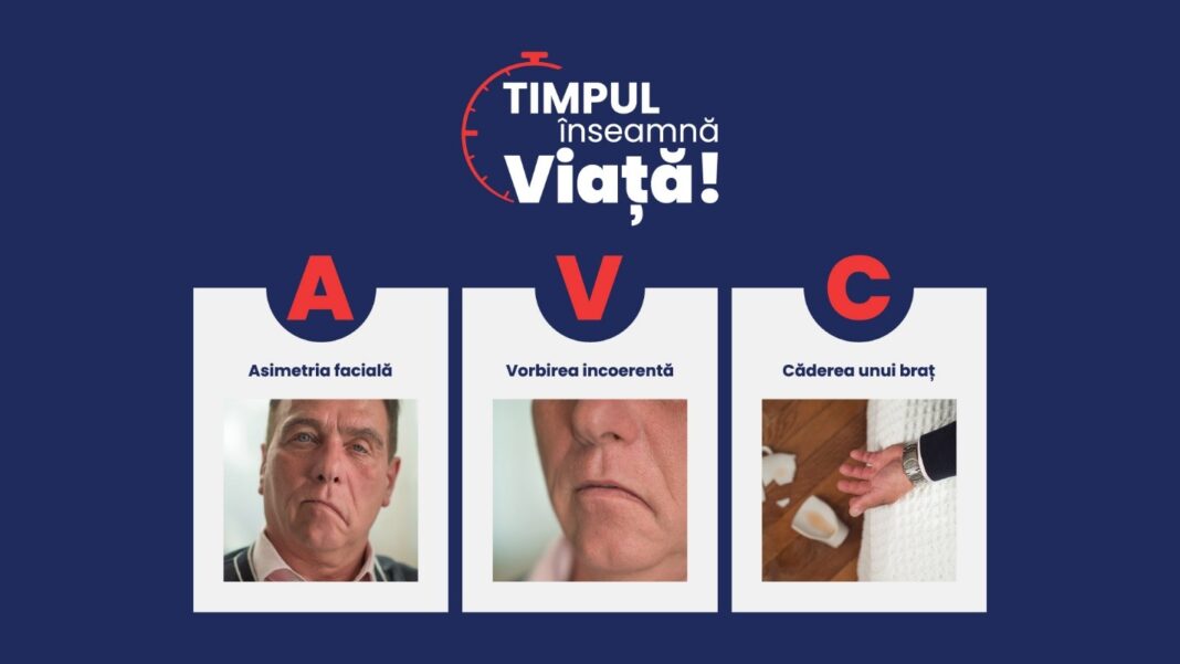 imagine simptome Semnele unui AVC