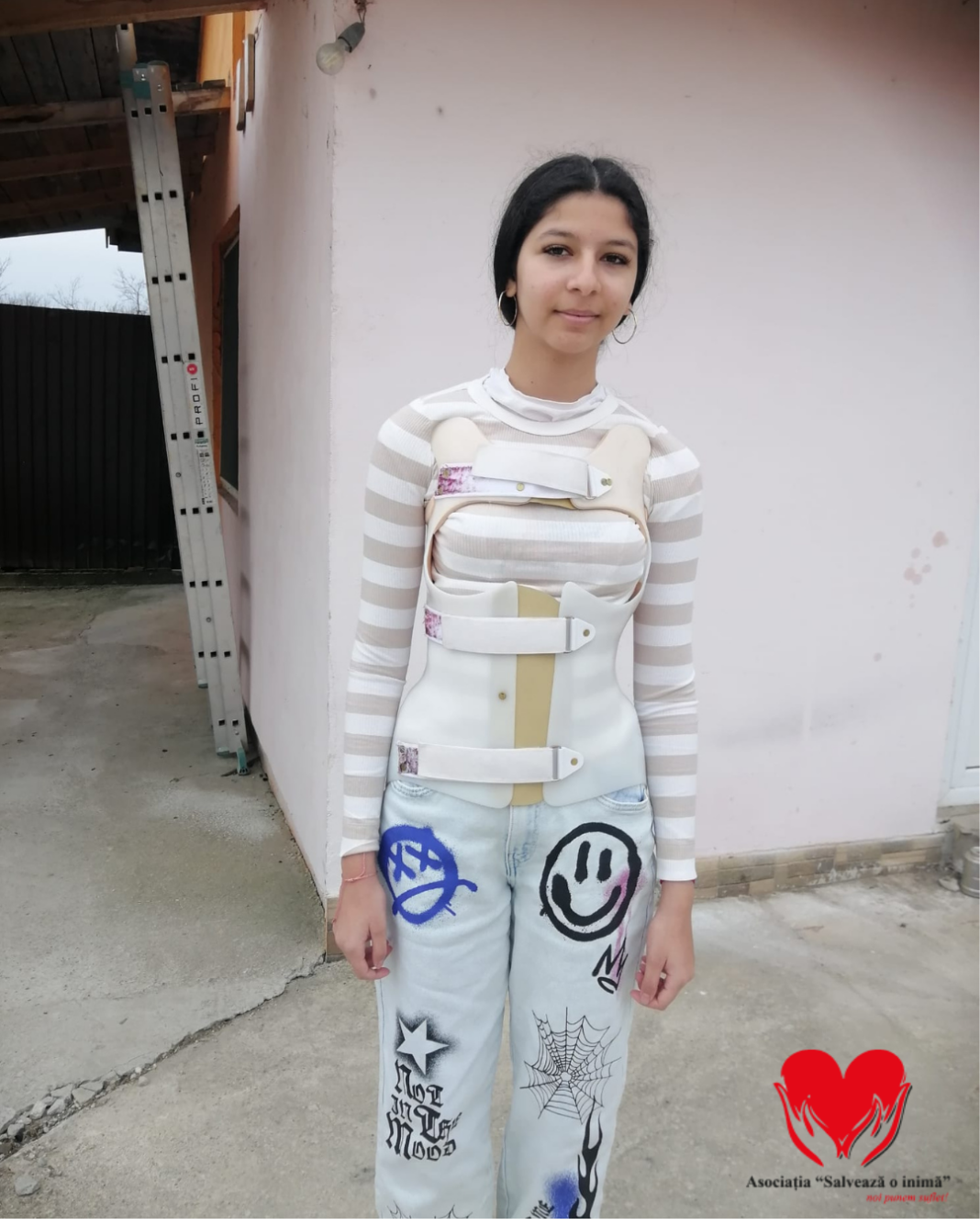 Erika are nevoie urgent de o operație de 35.000 € pentru a putea trăi fără durere