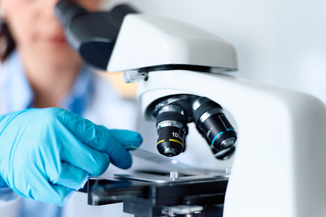 Indiciul care ar putea schimba tratamentele pentru Parkinson