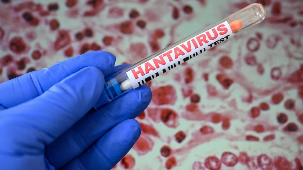 Tânărul confirmat cu hantavirus a fost externat