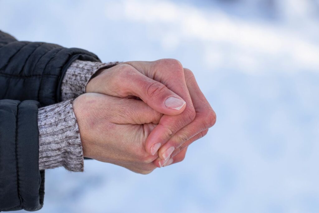 Pielea uscată, o problemă frecventă în sezonul rece. Ce obiceiuri agravează simptomele